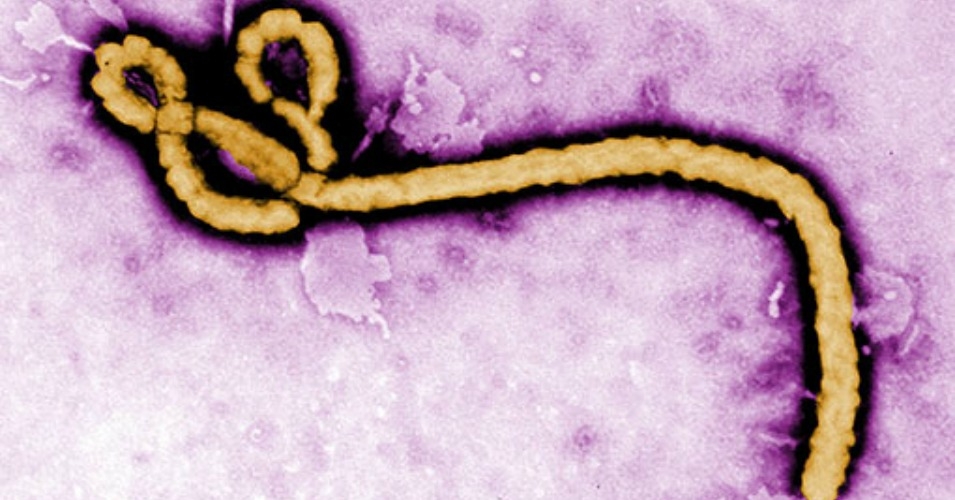 CDC Confirms First Case of Ebola Diagnosed in US